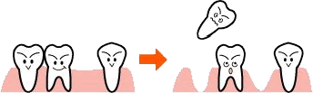 イラスト